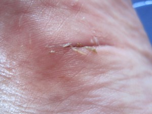 Kuttet i foten min. :(